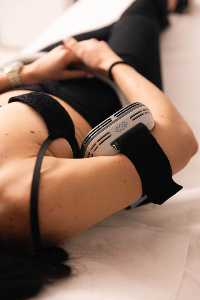 Applicatore EMSCULPT sul braccio per la tonificazione di bicipiti e tricipiti
